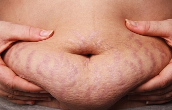 baby that’s a stretch